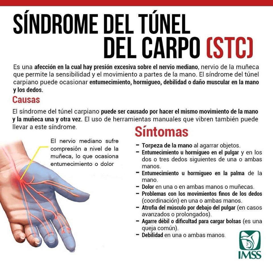 Campaña de prevención del Sindrome de Tunel Carpiano